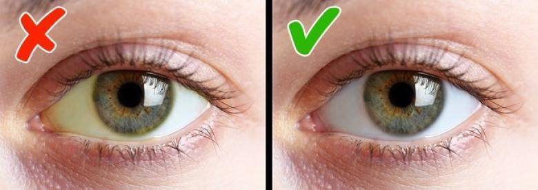 Как сделать белки глаз белыми?